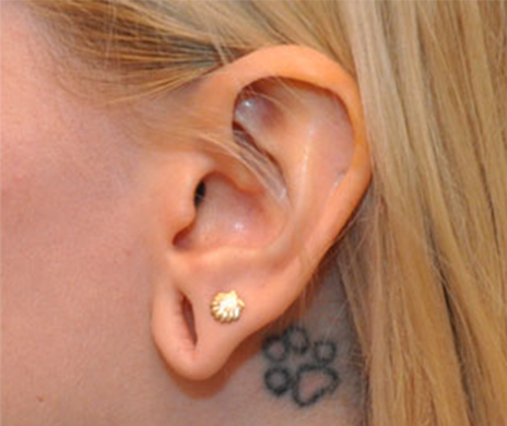 gauged earlobe